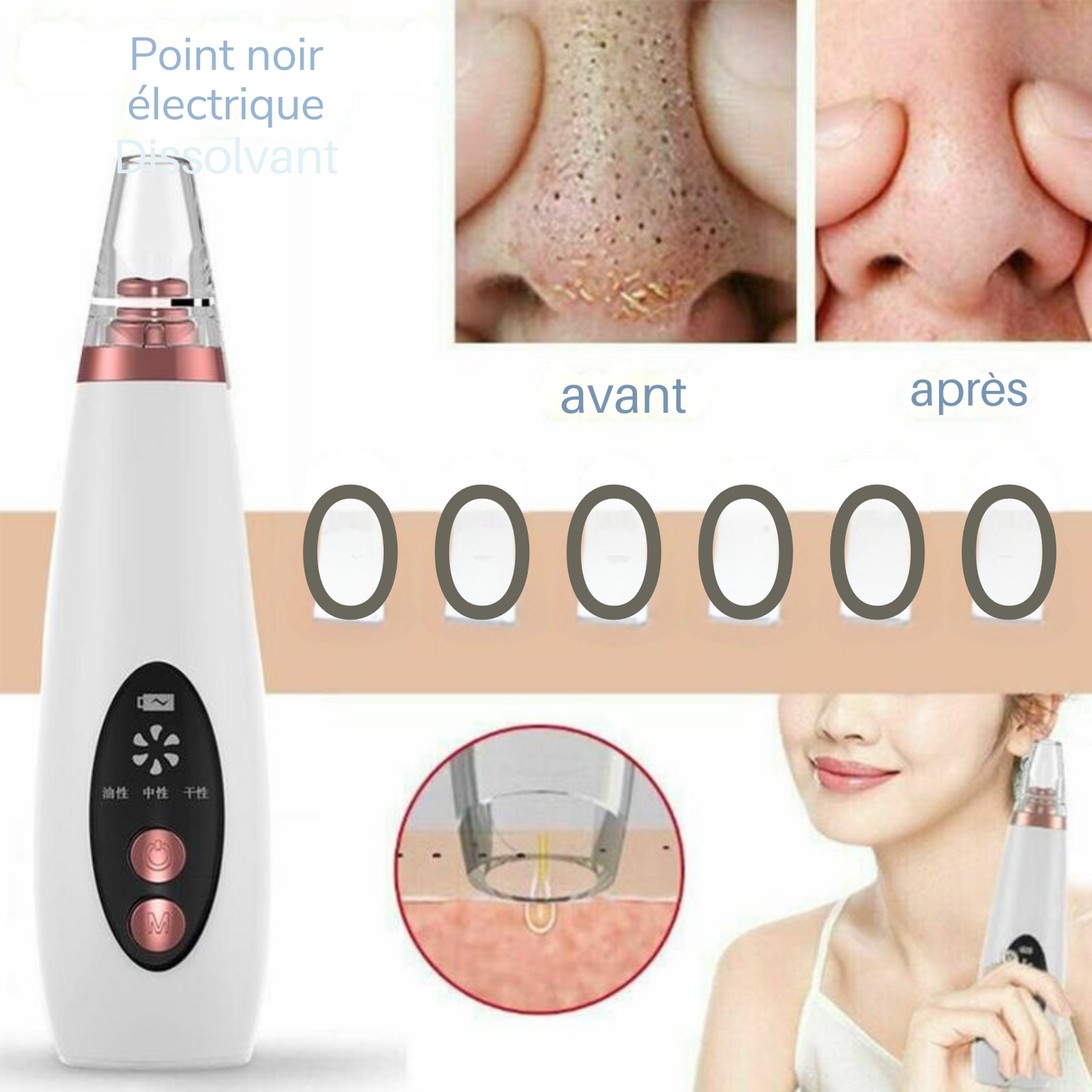 Appareil de Nettoyage des Pores – Aspirateur de Points Noirs pour Soins du Visage à Domicile
